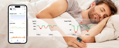 R13 O2Ring — Continuous Blood Oxygen SpO2 & Pulse Rate Monitor, 16-Hour Battery, Sleep Apnea Tracking